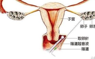 金沙有不孕不育医院吗（南京长江医院不孕不育医院怎么样）