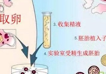 深圳试管婴儿医院排名：北京大学深圳医院排名第一？
