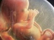 在山西省做试管婴儿长方案周期需要多久？超长方案促排流程是怎么样的？